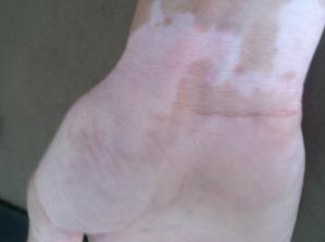 87.jpg